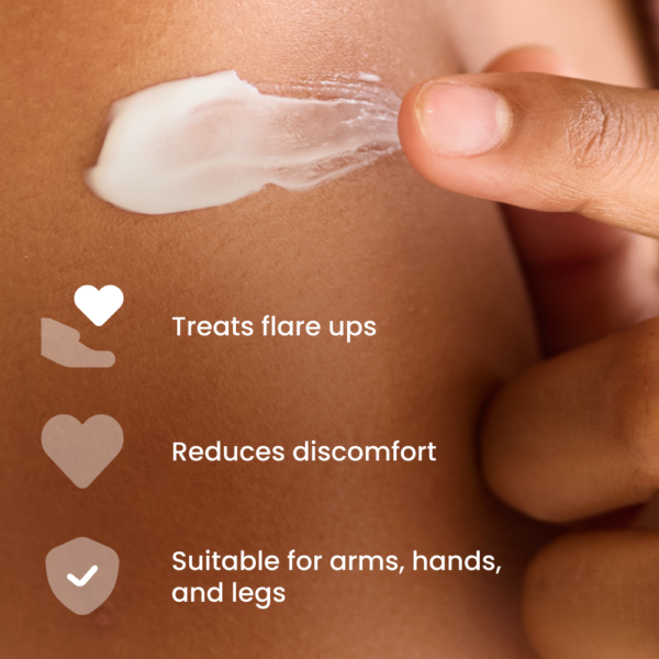 Eumovate Eczema & Dermatitis Cream (15g)